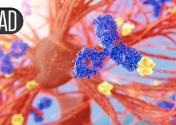 Alzheimer’s Benefits May Continue After Donanemab Treatment Ends, Data Suggest