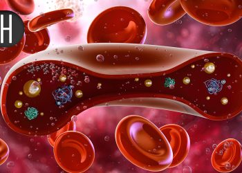 Potential Game-Changing Impact on Mismatched Unrelated Blood Cell Transplantation