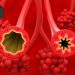 Second Biologic Might Improve Tolerability of Multi-Food Allergy Immunotherapy