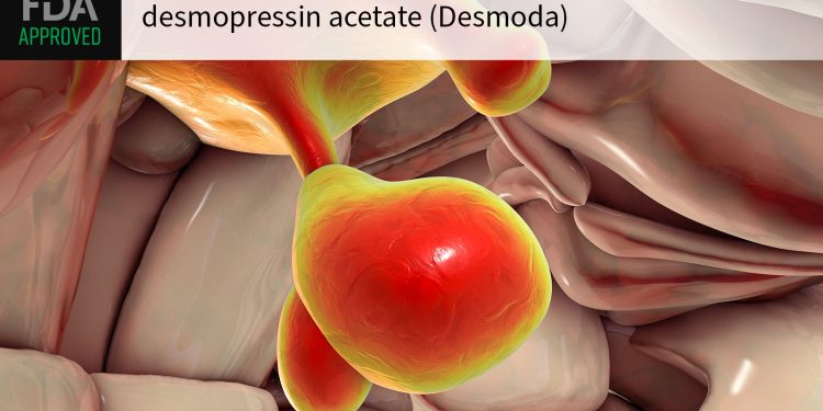FDA Approves Desmoda for Central Diabetes Insipidus