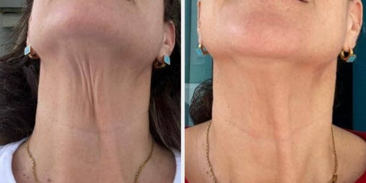 27 Products With Results That Are So Enthralling, You’ll Feel Like You’ve Been Missing Out