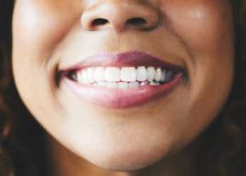 No, white teeth don’t mean healthy teeth