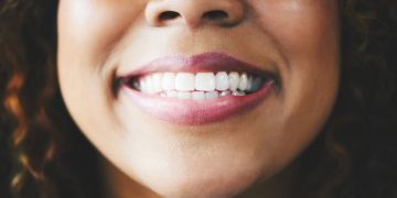 No, white teeth don’t mean healthy teeth