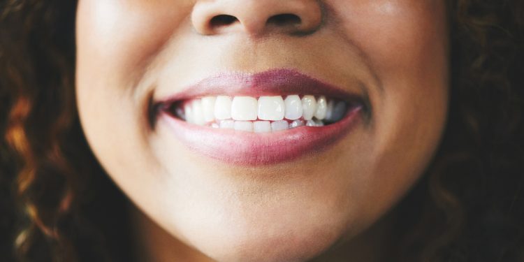 No, white teeth don’t mean healthy teeth