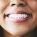 No, white teeth don’t mean healthy teeth