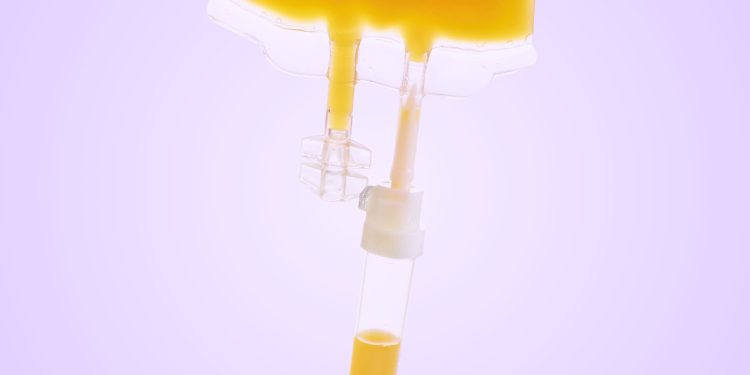 Can Swapping Out Your Plasma Slow the Aging Process?