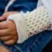 Large trial shows bone healing ‘superpower’ in children