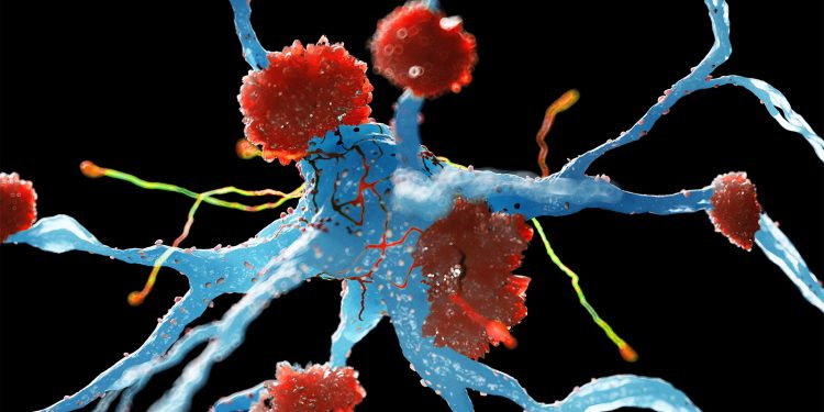 Alzheimer’s Drug Review Ignites Backlash From Experts