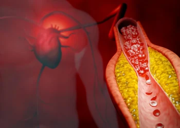 New treatment cuts bad cholesterol by nearly 50% without statins