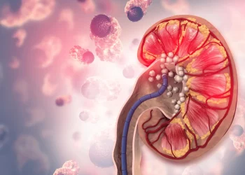 Why drinking more water didn’t prevent kidney stones