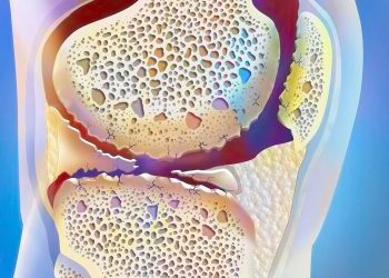 This Growth Factor May Play a Bigger Role in Osteoarthritis Than Previously Thought