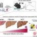 New mouse model of virus-driven liver cancer may boost diagnosis and treatments