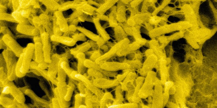 Multiple Drugs Flagged for Higher C. Diff Risk