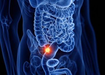 Are We Missing Tumors When Using Antibiotics Alone for Appendicitis?