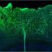 Astrocyte NF-κB activation triggers harmful inflammation and poorer recovery after traumatic brain injury, finds study