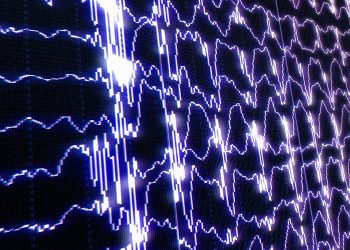 Brain Waves During Sleep Predict Dementia Risk