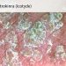 ‘Potential Game Changer’ for Psoriasis Gets Green Light From FDA