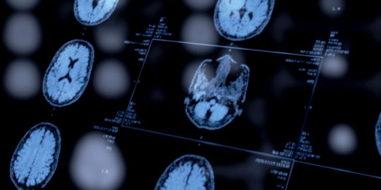 Psychiatrists’ Use of Biomarkers Could Open a New Window Into Mental Health Diagnoses