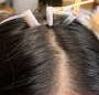 Thermoreversible biogel may solve a hairy problem for wearable brain-monitoring systems
