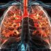Whole Blood Not Better Than Components En Route to Hospital After Traumatic Injury