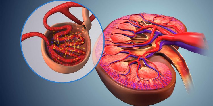 Competition Builds for Novel IgA Nephropathy Approach