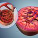 Competition Builds for Novel IgA Nephropathy Approach