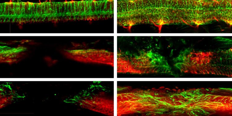 Injectable nanorobots may help heal spinal injuries