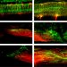 Injectable nanorobots may help heal spinal injuries