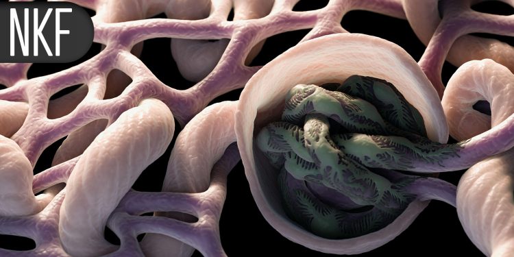Apixaban May Offer a ‘Practical Alternative’ for Dialysis Patients With Afib