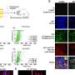 Obesity-linked fat molecule may speed Alzheimer’s by disrupting brain lipids