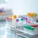 Not just insulin: Early increases in glucagon in type 2 diabetes are linked to fatty liver disease