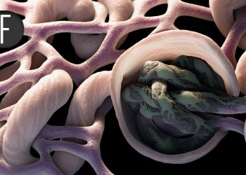 Protein Supplement Tied to Better Outcomes for Patients on Dialysis