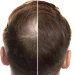 Ancient Chinese medicine could transform hair loss treatment