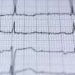 AI-powered electrocardiogram detects early signs of heart failure