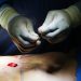 Cosmetic Interventions Are Booming. Many Say Ethical Conversations Are Lagging.