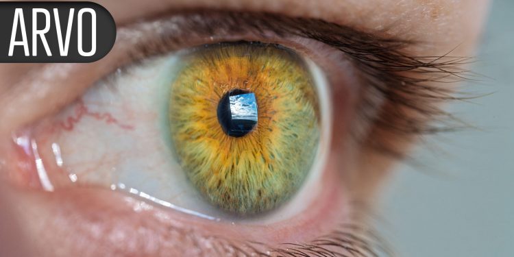 Erectile Dysfunction Drugs Linked to Lower Glaucoma Risk in Men