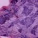 New 3D microscope technology captures high-resolution tissue images at a fraction of the cost