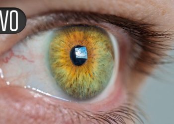 Vision-Correction Procedure Linked to Higher Level of Neuroticism Traits