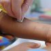 Are Food Allergies Overdiagnosed in Black Patients?