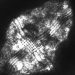 ‘Cyborg’ Islet Cells and Potential New Diabetes Therapies