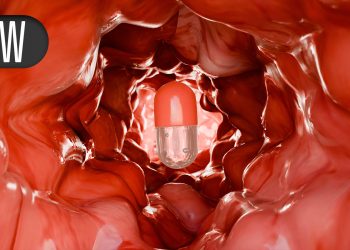 Can Endoscopic Procedure Slow Post-1 Weight Rebound?