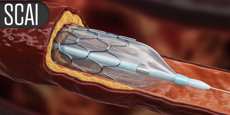 GLP-1 Drugs Make Promising Debut in TAVR, Carotid Artery Stenting