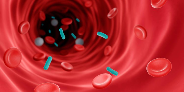 Two Resuscitation Fluids Led to Similar Outcomes in Kids With Septic Shock