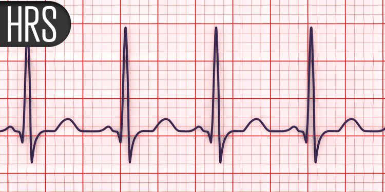 Think Heart Attacks Cause Most Sudden Cardiac Deaths? Think Again, Study Says