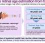 AI can use a photo of the eye to estimate retinal age, flag risk for major diseases