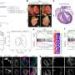 A newly uncovered gene switch rewires infant heart cells and opens a treatment path for a deadly disease