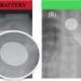 New button battery technology shows promise, but swallowing remains an emergency