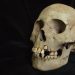 Ancient Teeth Push the Plague’s Timeline Back to Over 5,500 Years Ago