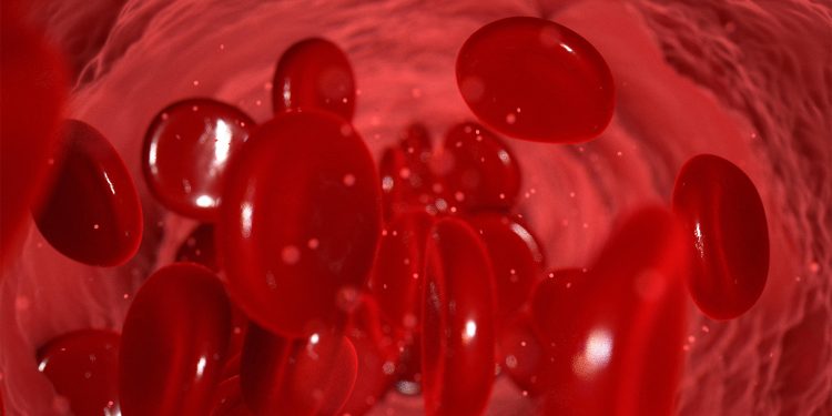 This Test Outperformed SCORE2 for Gauging Heart Risk in Rheumatic Disease