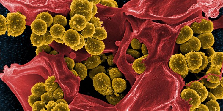 Cefazolin Proves Its Mettle for Methicillin-Susceptible Staph Infections